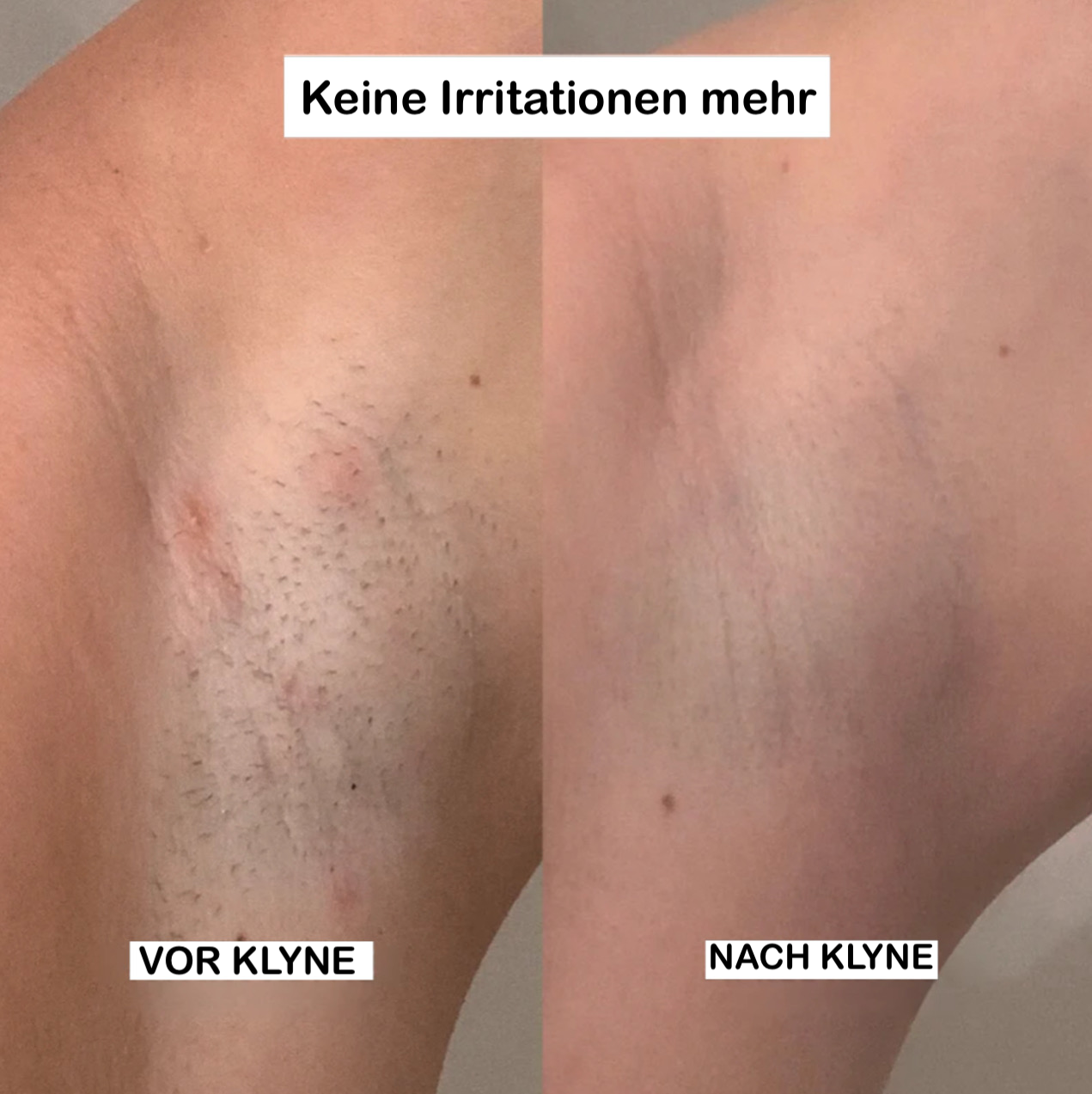 Ultimative Damenrasierer für Unterwegs™