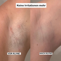 Ultimative Damenrasierer für Unterwegs™